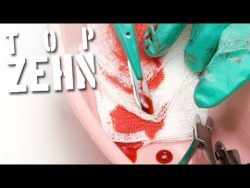 10 bizarre medizinische eingriff 1